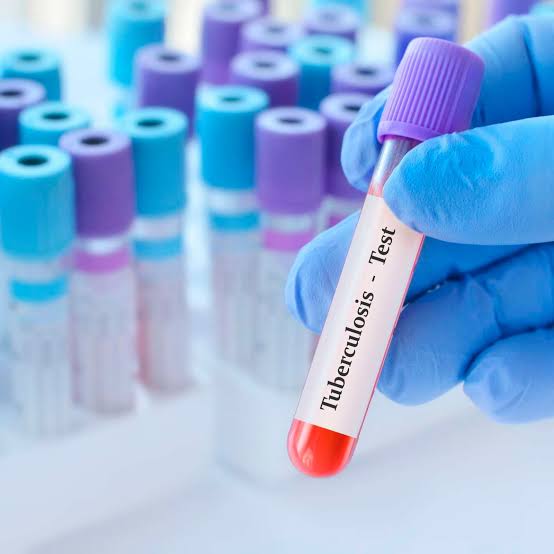 tb test